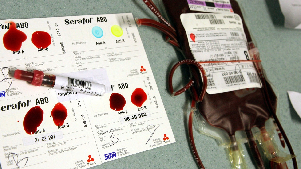 Beutel mit Blut werden mit Übereinstimmung der Blutgruppen überprüft