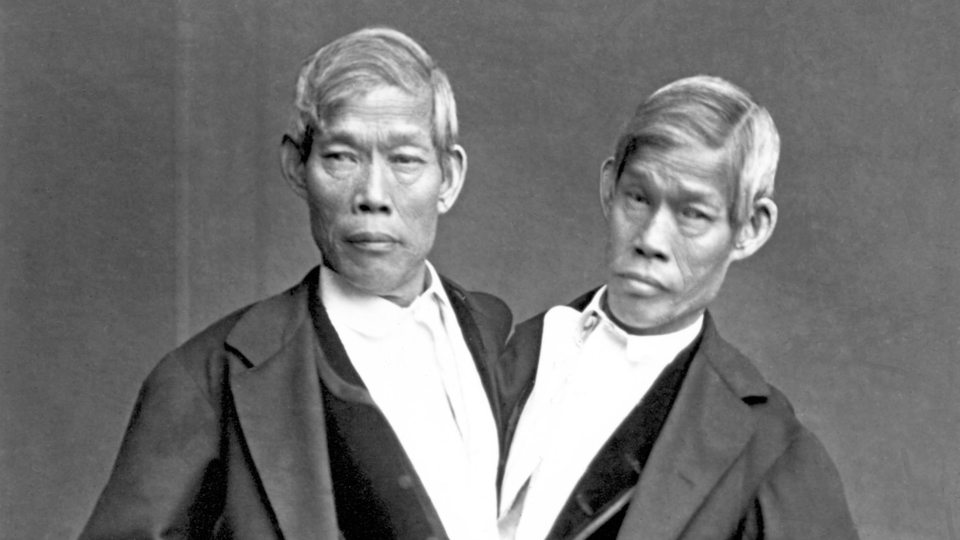 Die siamesischen Zwillinge Chang und Eng Bunker auf einer zeitgenössischen Fotografie